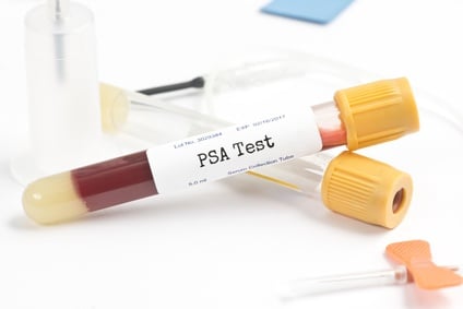 PSA Test dépistage cancer prostate