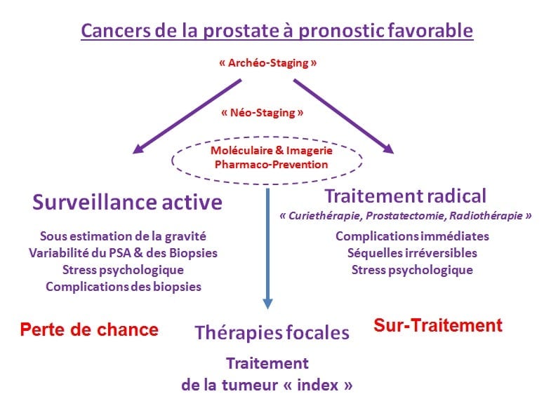 Image cancers prostate pronotic favorable