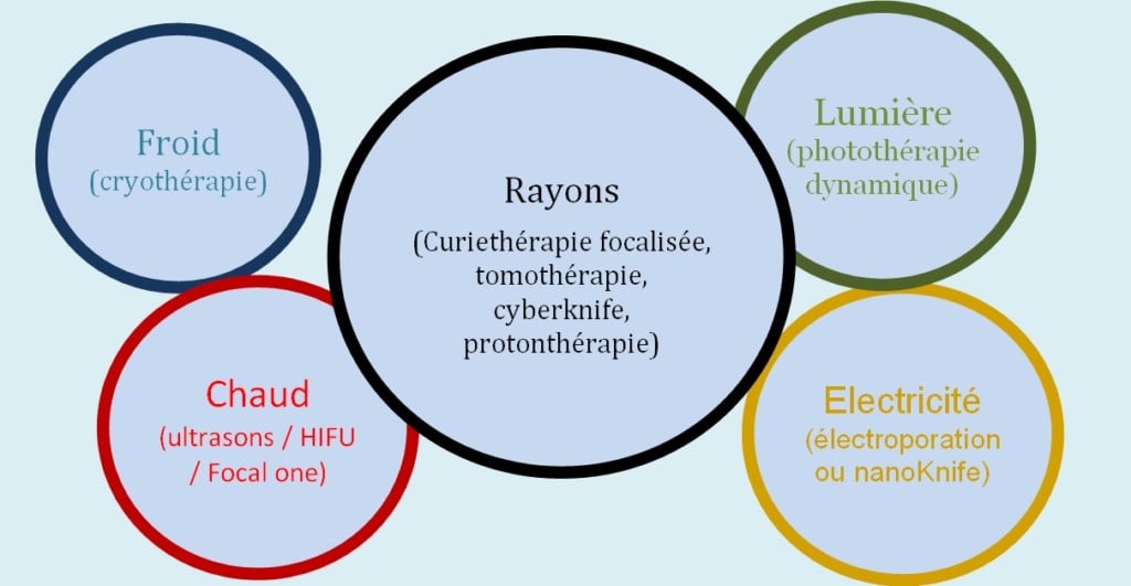 RT Cancer de La Cavité Buccale 19